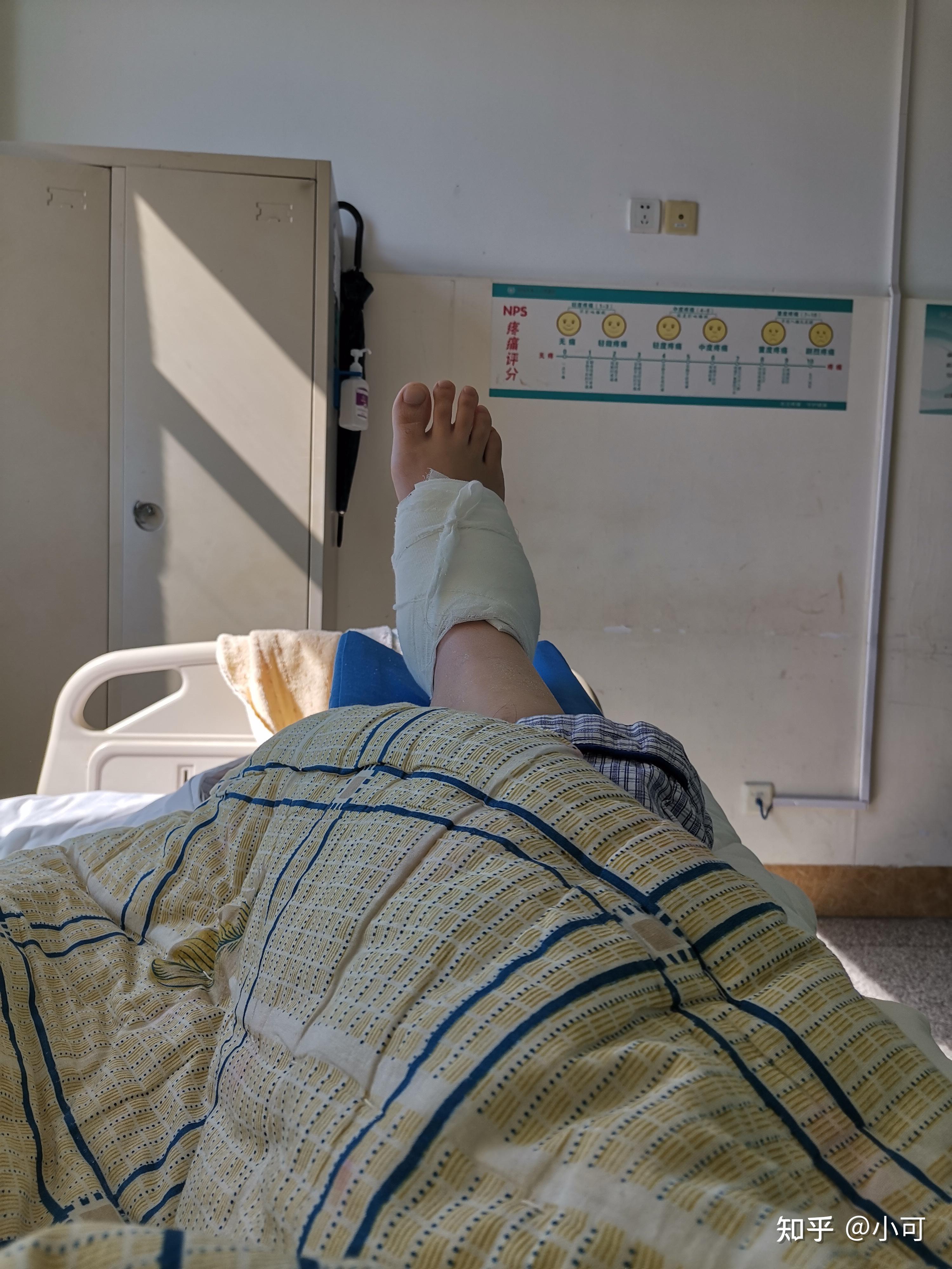 足跟骨折治疗过程