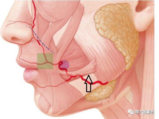 5,提口角肌提口角肌起自眶下孔下方的尖牙窝,与口轮匝肌相连,附着于蜗
