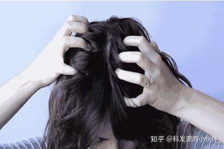 头皮痒怎么办 八招方法教你轻松解决 - 知乎
