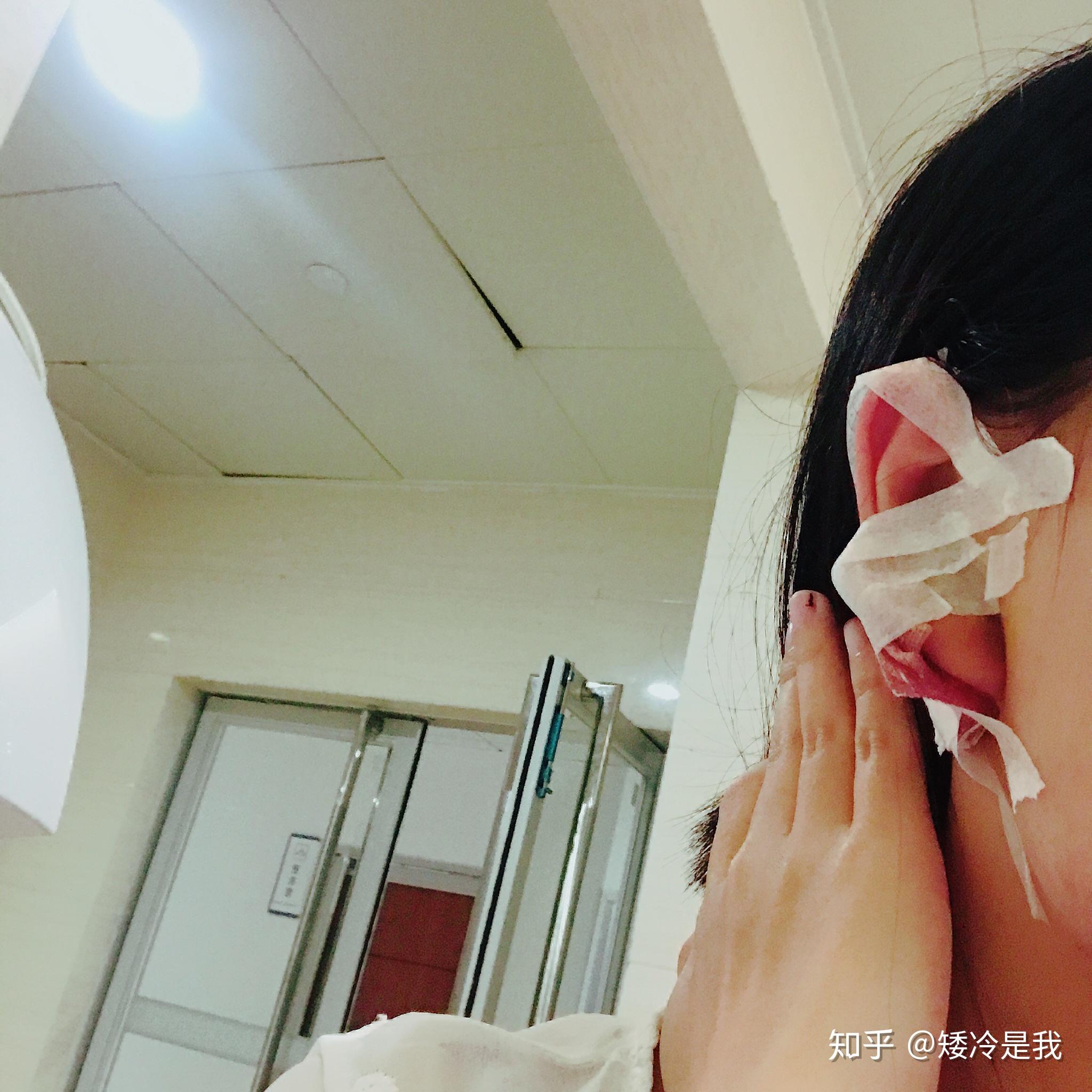 耳朵后面长了个包医生说是皮脂腺囊肿不想开刀有没有什么偏方能消肿