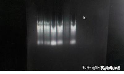怎样判断你提取的RNA质量好坏？ - 知乎