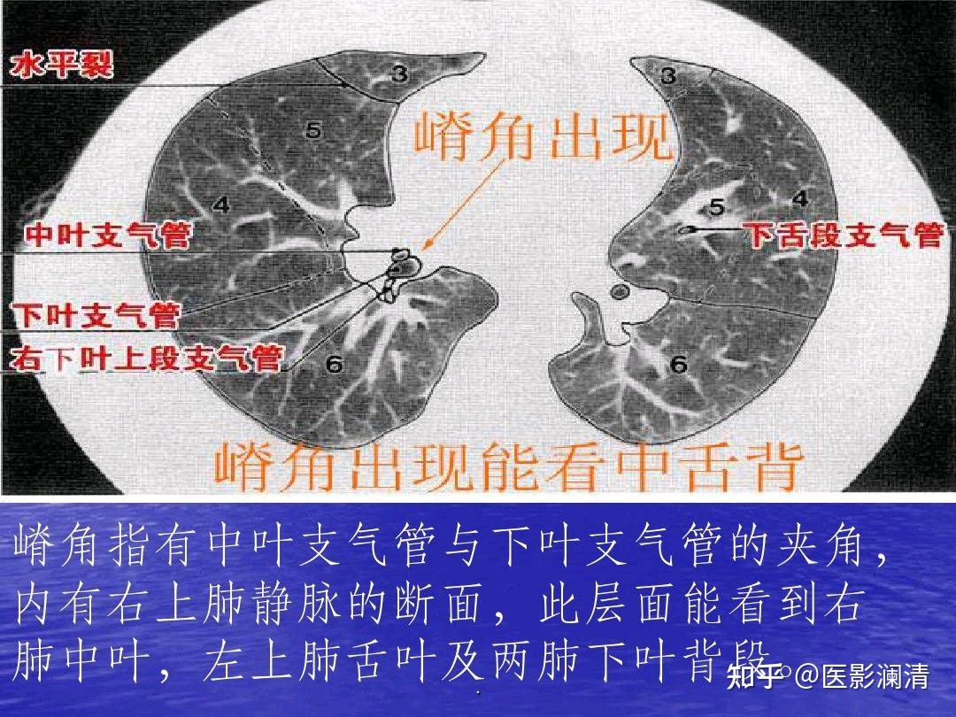 肺部ct分段解剖图图片