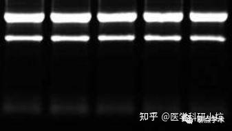 怎样判断你提取的RNA质量好坏？ - 知乎