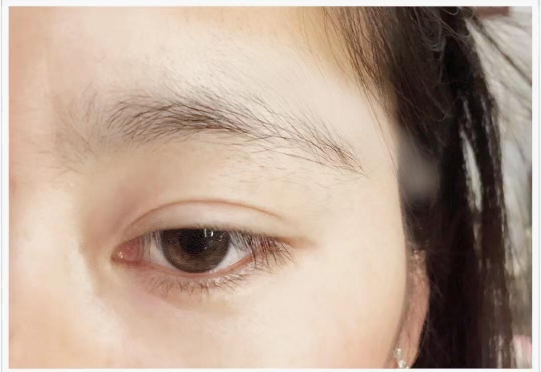眉毛淡且少怎么浓眉