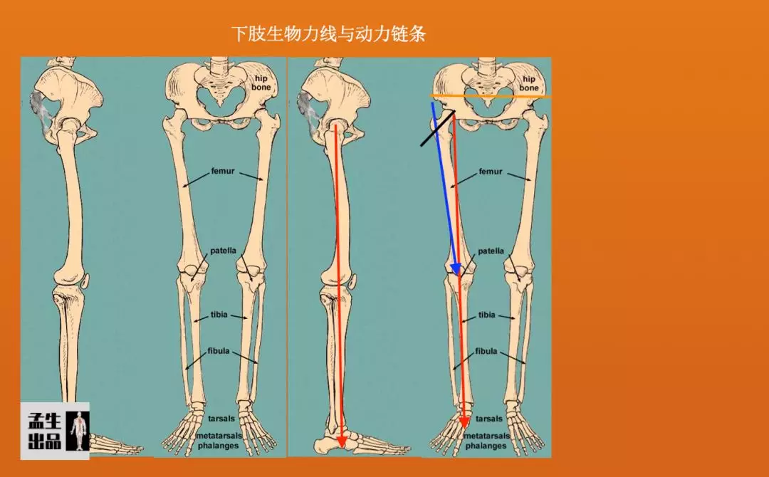 下肢力线示意图图片