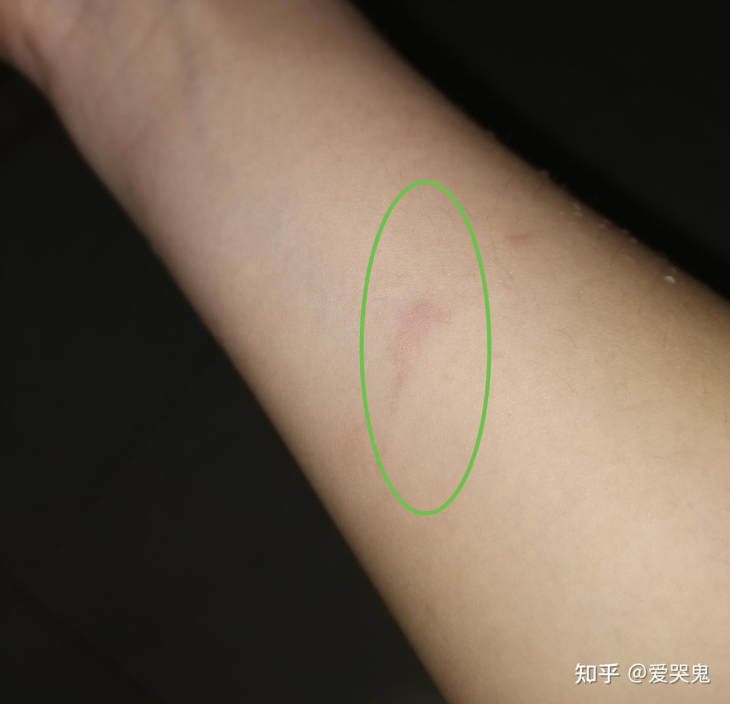 狂犬疫苗真的别乱打! - 知乎