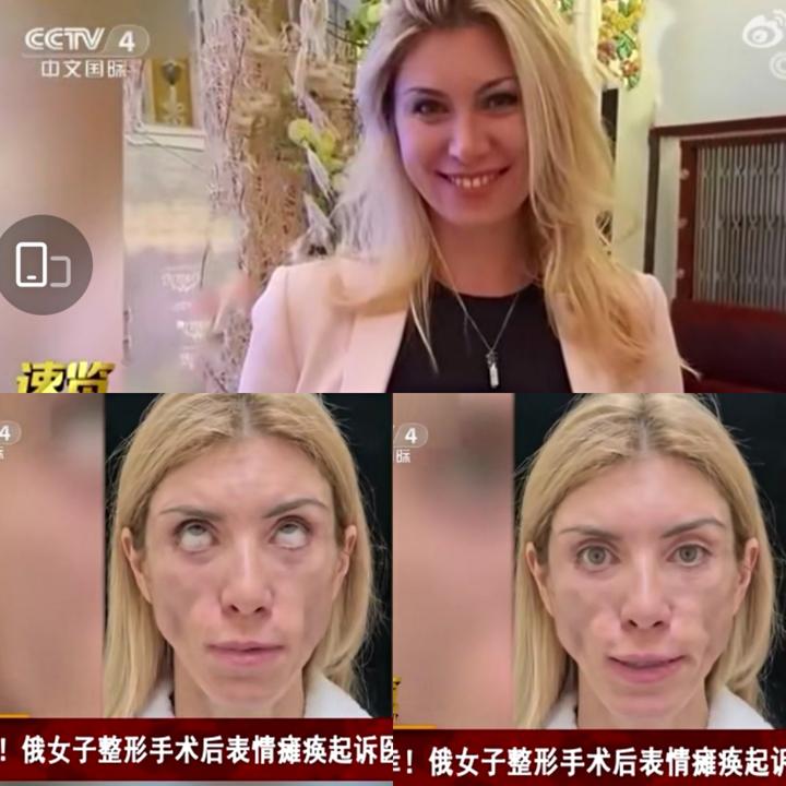 女人们不可不知的医美整形变毁容的那些事 - 知乎