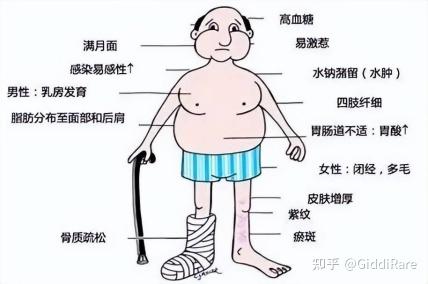 破局库欣综合征！内分泌罕见病创新药美替拉酮中国内地首发 - 知乎