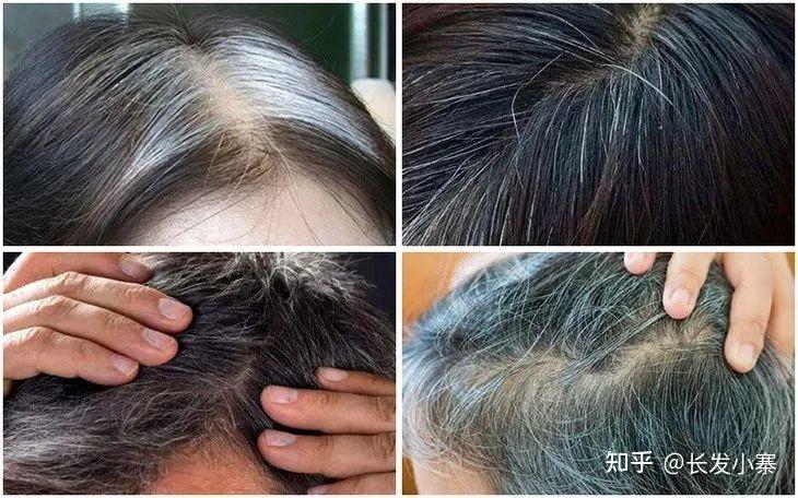 长发小寨给白发者的一封信 - 知乎