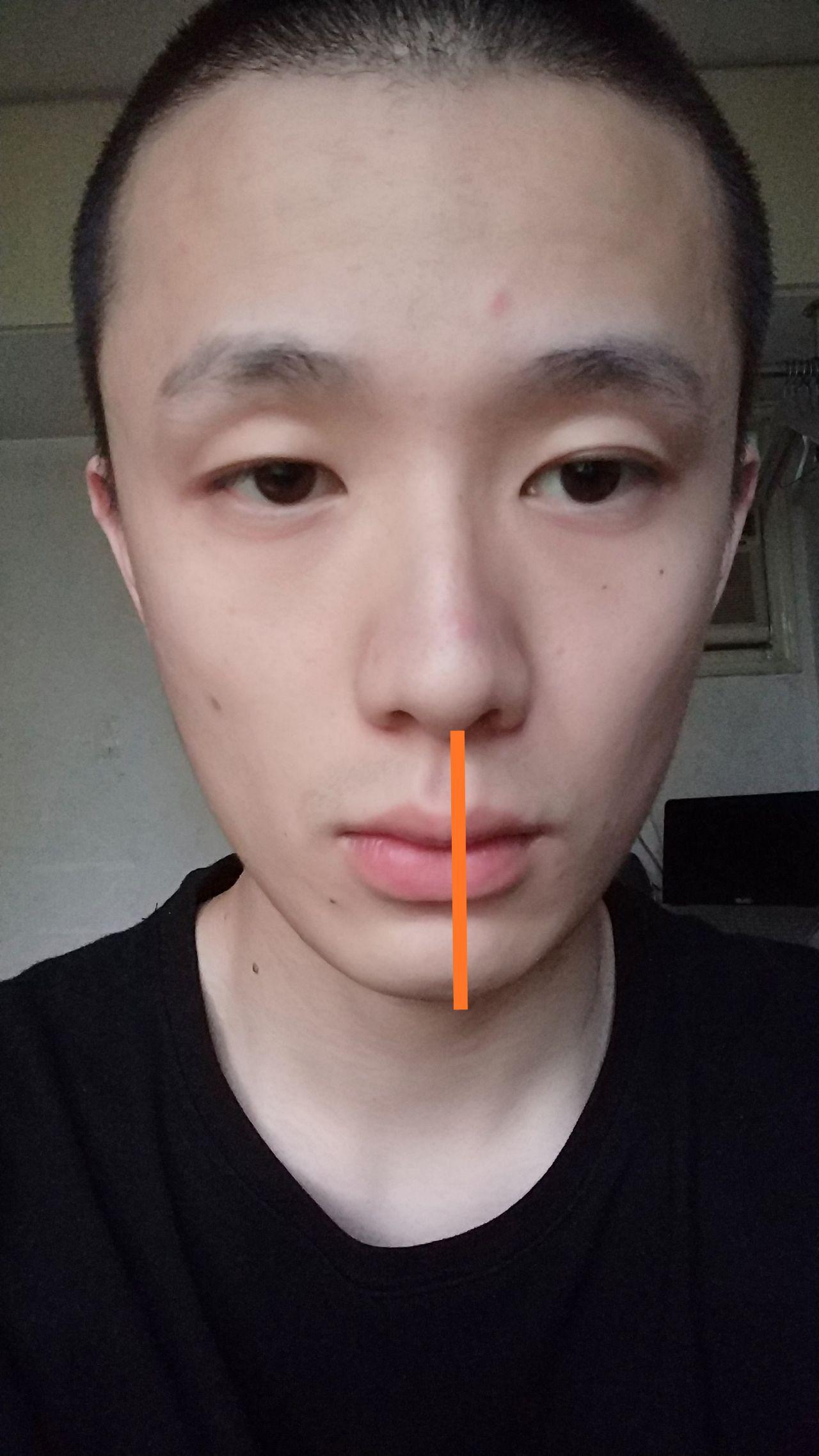 长期实用脸部一边吃饭会不会导致歪脸在嘴巴