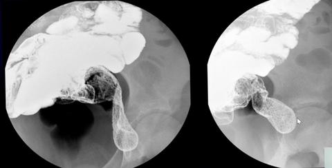 梅克尔细胞 - 知乎