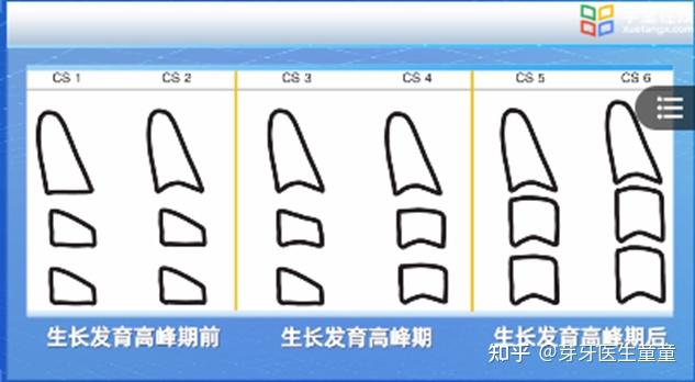 正畸课程自学笔记 - 知乎