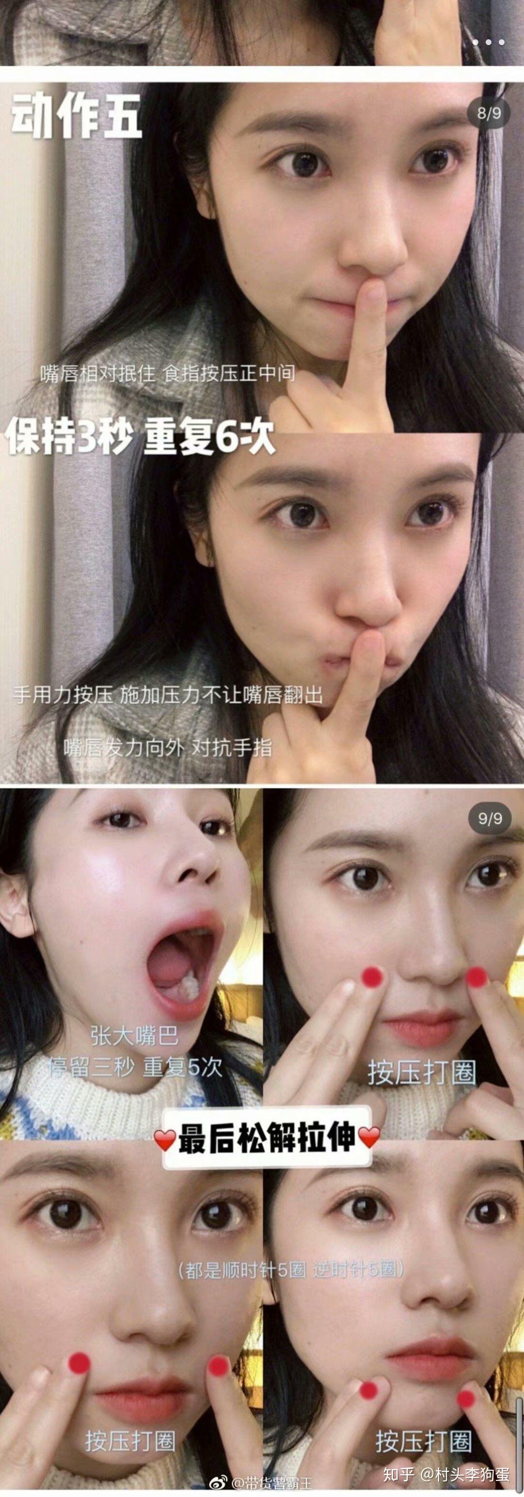 我是一个女生17岁我的上嘴唇外翻 就是上嘴唇很大下嘴唇正好合适 有