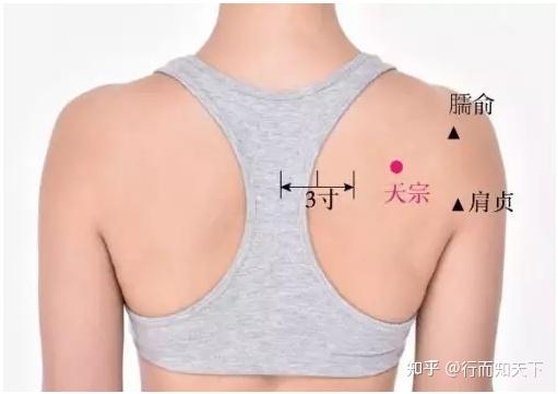 肩周炎五十肩的調理與改善