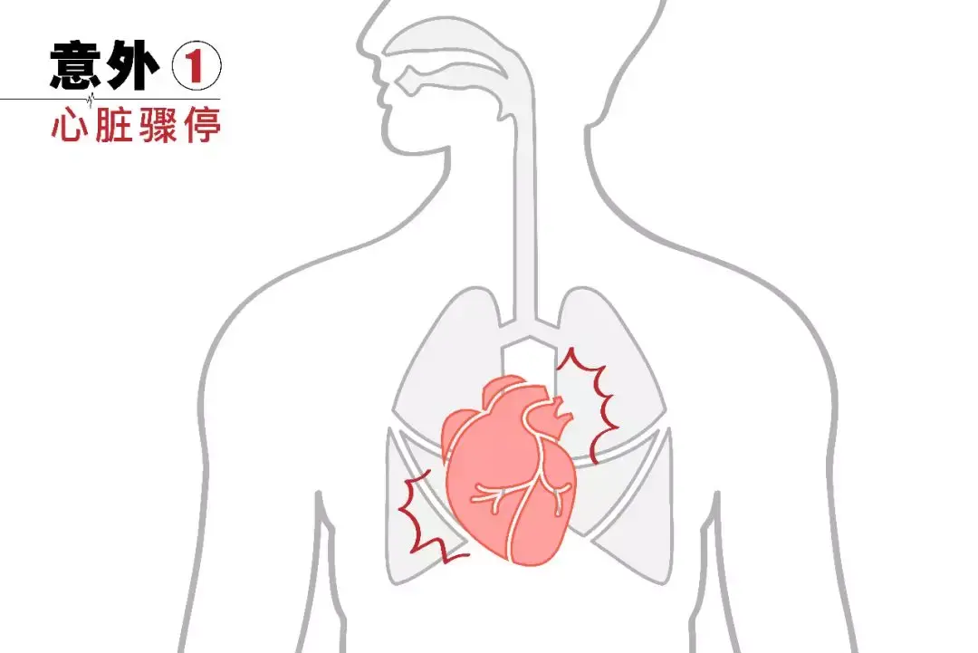 心肺简笔画图片