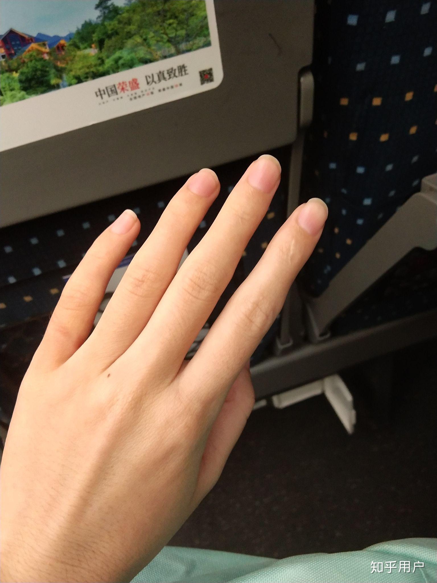 女生的手怎样变好看