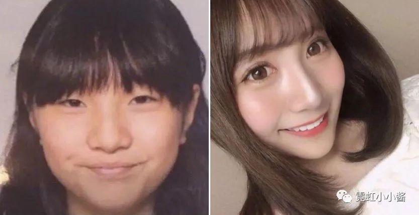 狗血 被爱豆嫌弃丑 整容成大眼正妹报复爱豆 日本医美 知乎 狗血 被爱豆嫌弃丑 整容成大眼正妹报复爱豆 日本医美 知乎