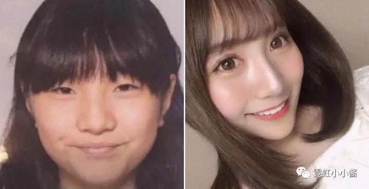 狗血 被爱豆嫌弃丑 整容成大眼正妹报复爱豆 日本医美 知乎 狗血 被爱豆嫌弃丑 整容成大眼正妹报复爱豆 日本医美 知乎