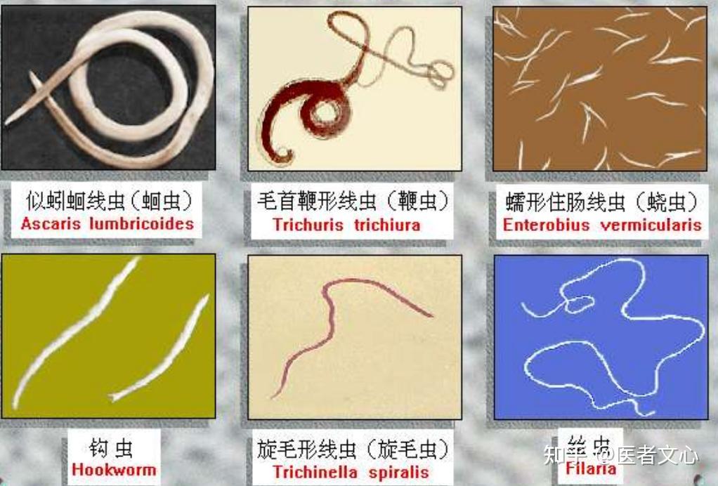 寄生虫的意思 zhuanlan.zhihu.com