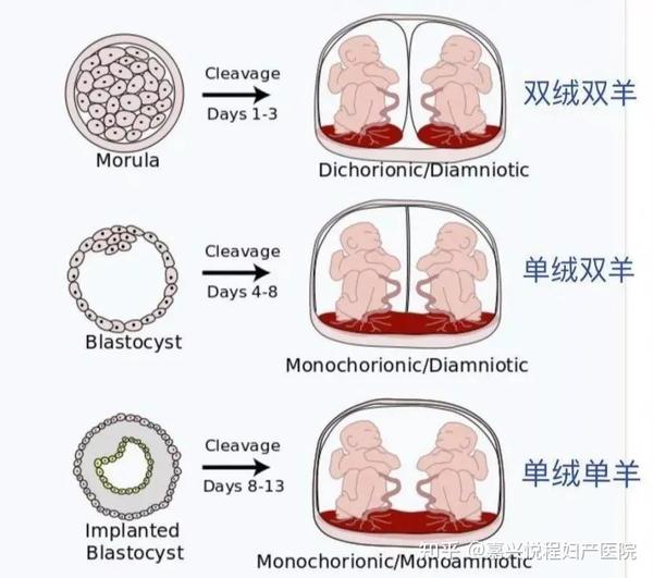 给双胎妈妈的一封信 | 双胎,几分欢喜几分忧 - 知乎