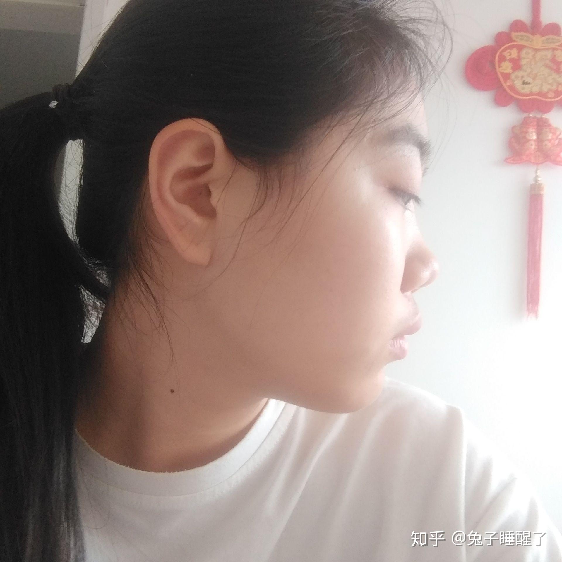 侧脸很平啊 怎么办啊 感觉脸就是一条线下去了 特别丑 眼睛近视还突