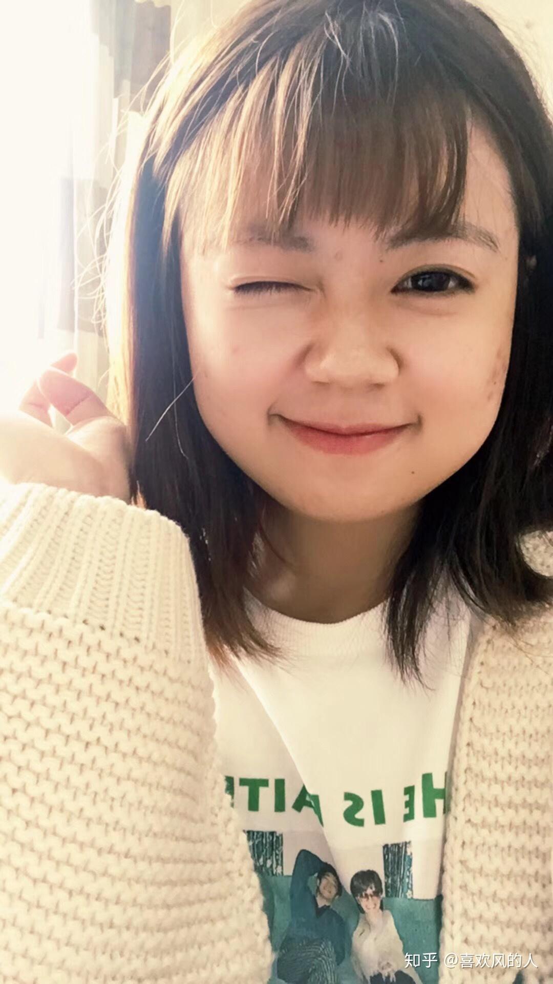 脸比较肉的女生适合短发吗?