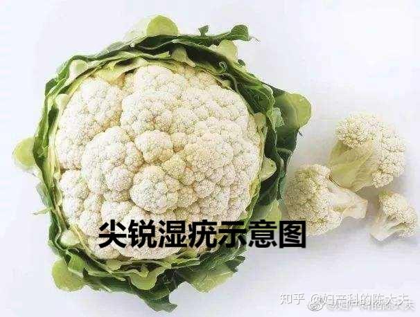 尖锐湿疣和假性湿疣傻傻分不清楚