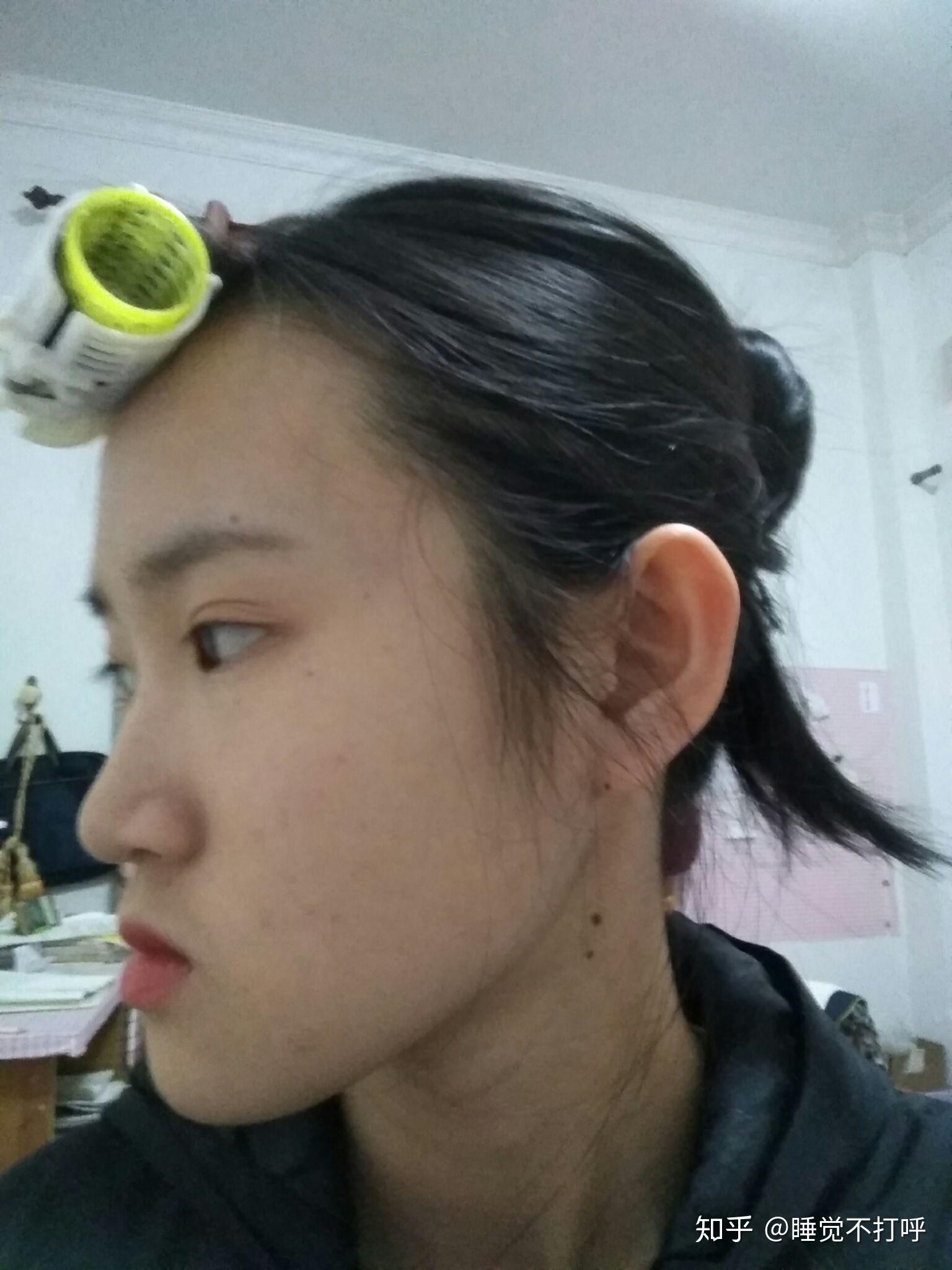 为什么正脸好看,而侧脸很丑 ? - 知乎