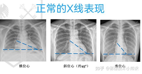 对你很有帮助的心脏影像知识 - 知乎