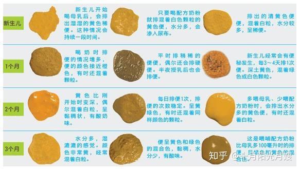 新手妈妈收藏了 了解宝宝便便 从颜色 气味 形状 次数观察宝宝大便是否正常 知乎