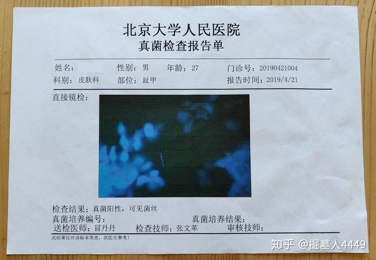 灰指甲怎么治疗用药 v2-625214e0ba3cb04044ab5c26e23e3f10_r.jpg