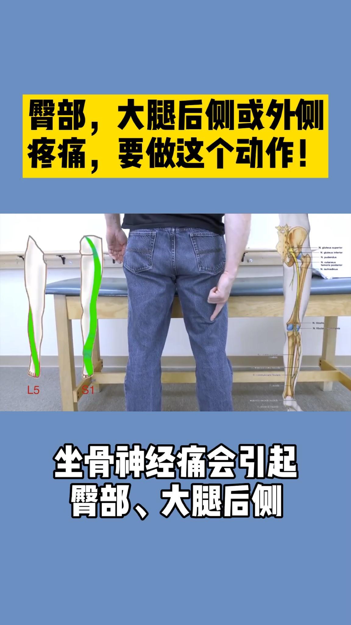 臀部大腿后侧后外侧疼痛小腿外侧麻一定要做这个动作