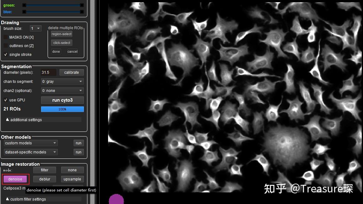 Cellpose 3.0 —— 一键图像恢复+细胞分割 - 知乎