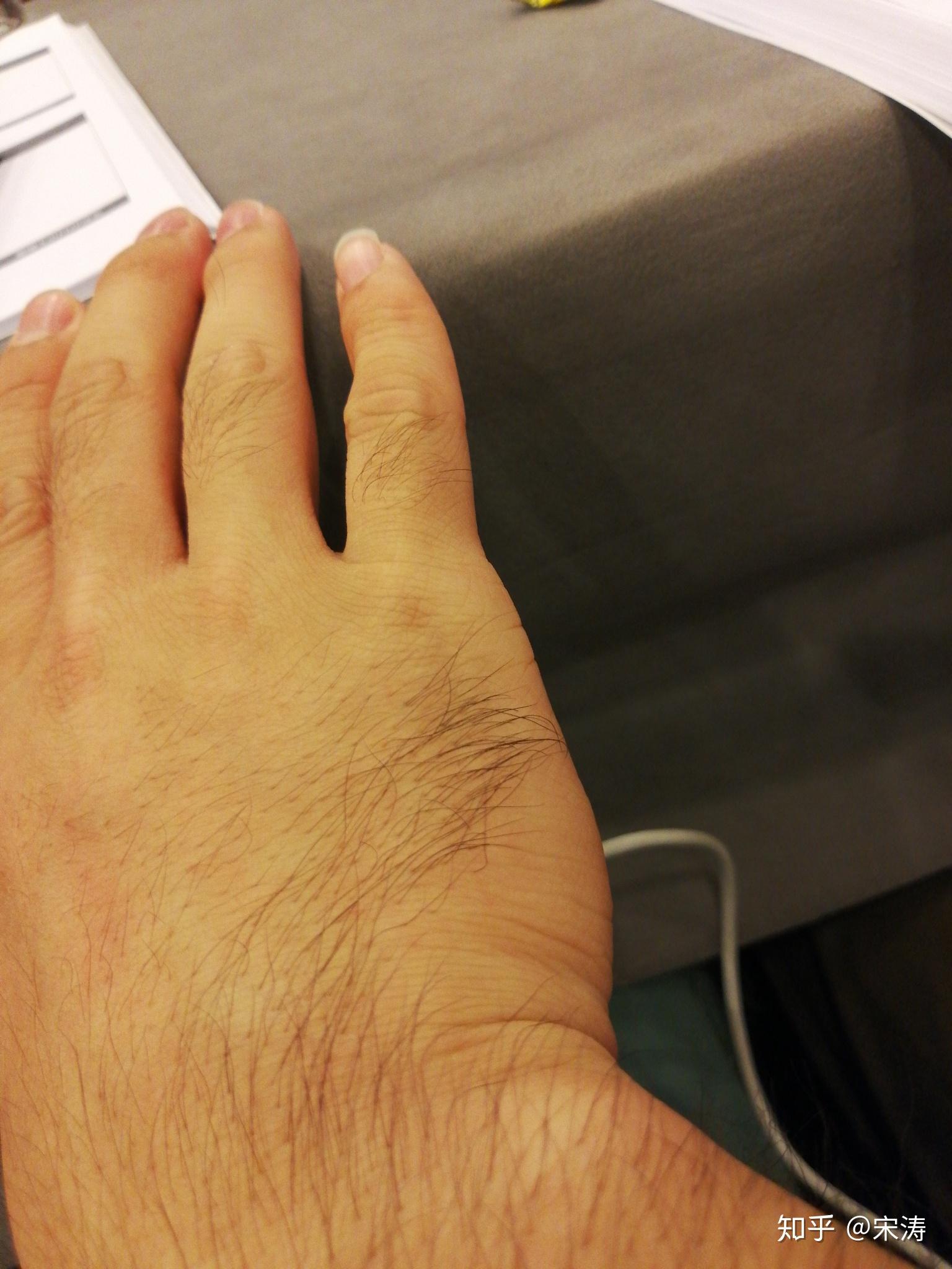 手毛长是一种怎样的体验