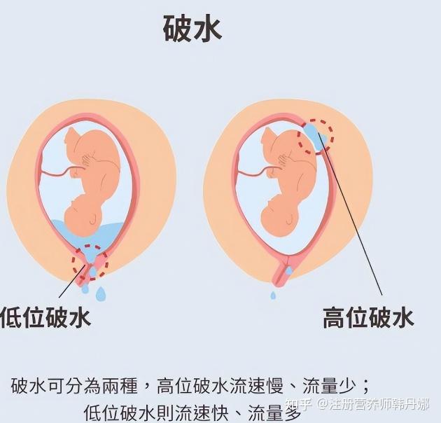 皇上羊水破了要生了图片