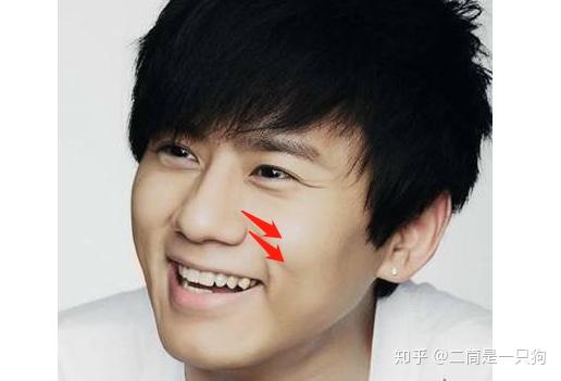 这几种类型的鼻子恭喜你可以单独做鼻翼缩小啦