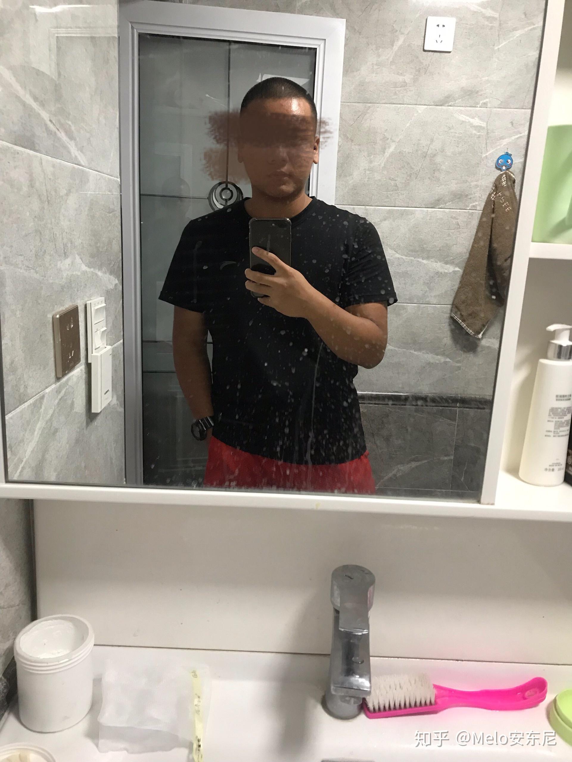 男生胸部的脂肪很多,胸部凸出来,穿衣服胸前两个"大包",一直被人嘲笑