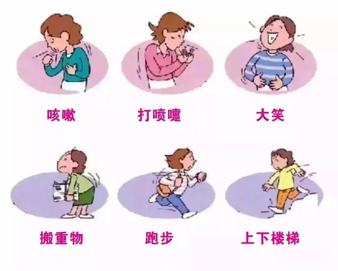 女人不为人知的尴尬——漏尿！ - 知乎