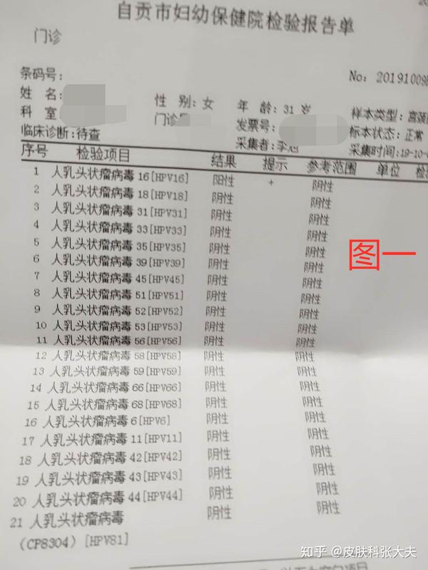 自贡市谭女士hpv16型高危转阴病例分享