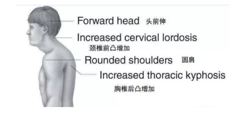 包等问题,今天我们就来讨论一下富贵包指的是在后背上部颈胸交界处,即