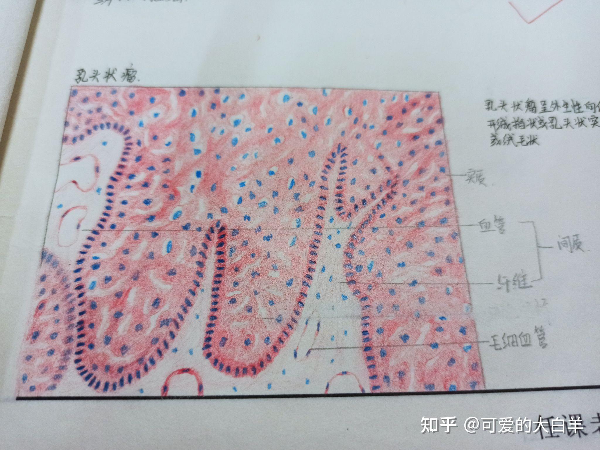 多形性腺瘤绘图图片