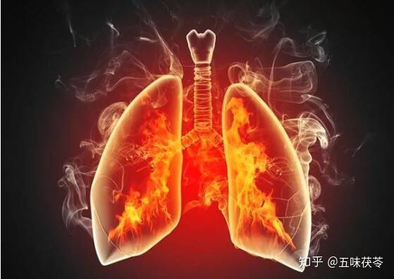 心火旺肝火旺肺火旺胃火旺中医降火要对症