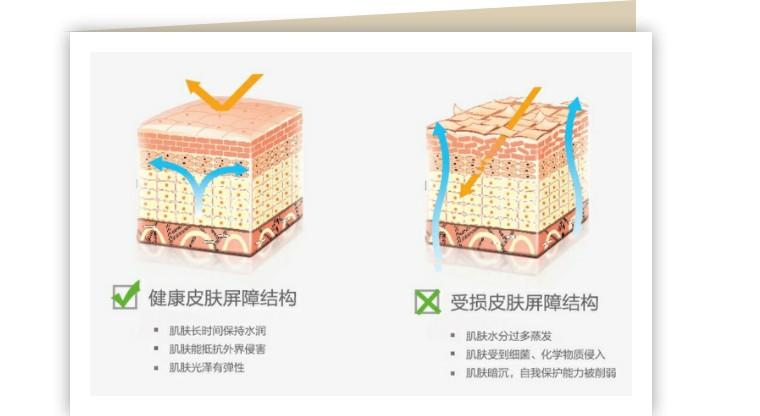 怎么知道自己是不是敏感肌?