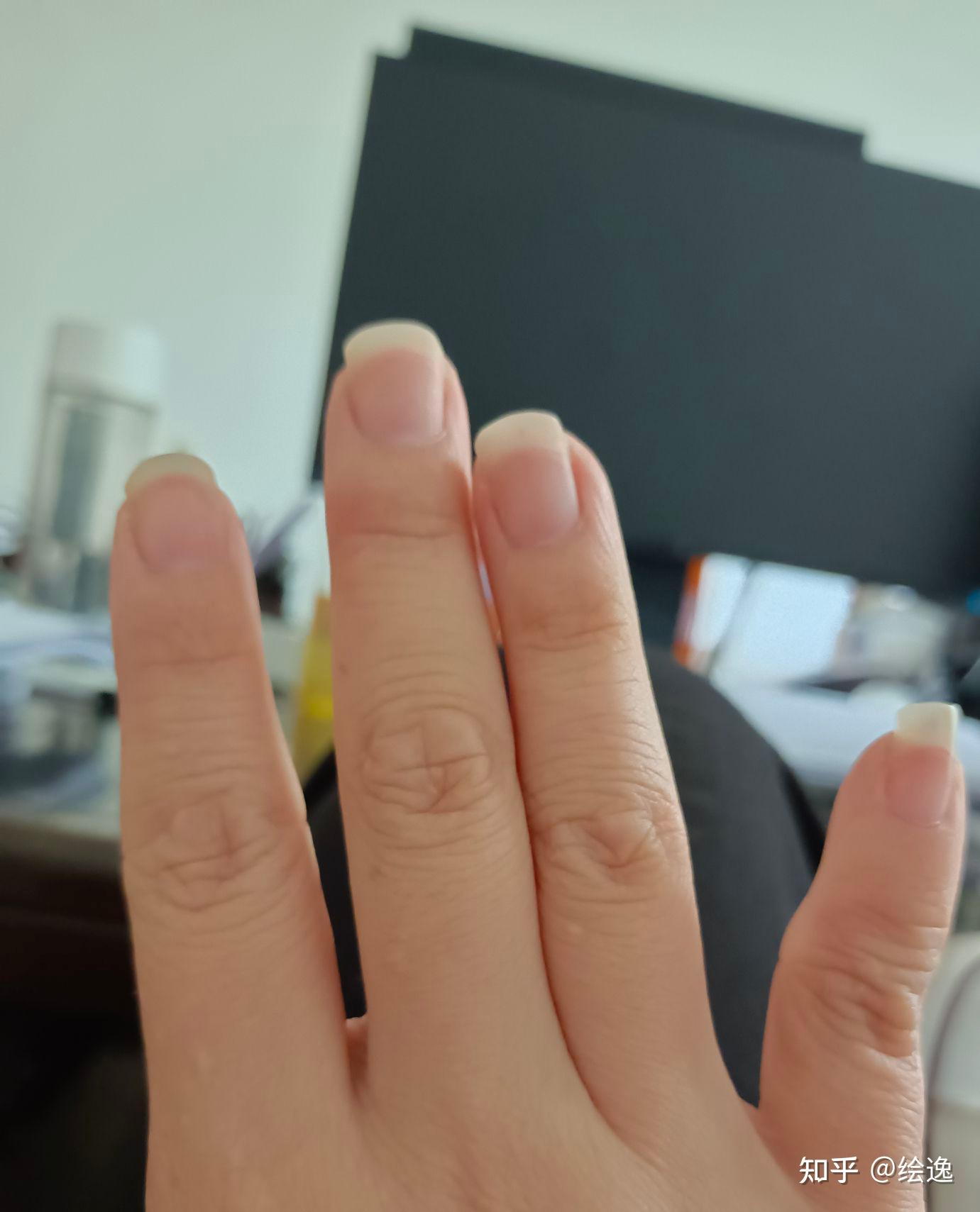 中指因为写字变形,有什么方法? - 知乎