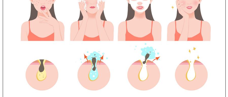 v2-6425c009f5f73b050dfcd376d1081042_1440w.jpg?source=172ae18b