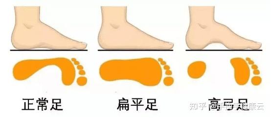 “宽厚”罗马脚、“美人”希腊脚,你知道自己是哪种脚型吗?搞懂这个穿鞋才舒服! - 知乎