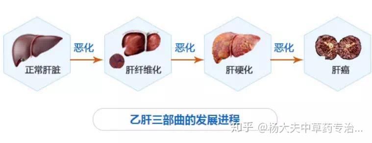 感染慢性乙肝到底有多严重
