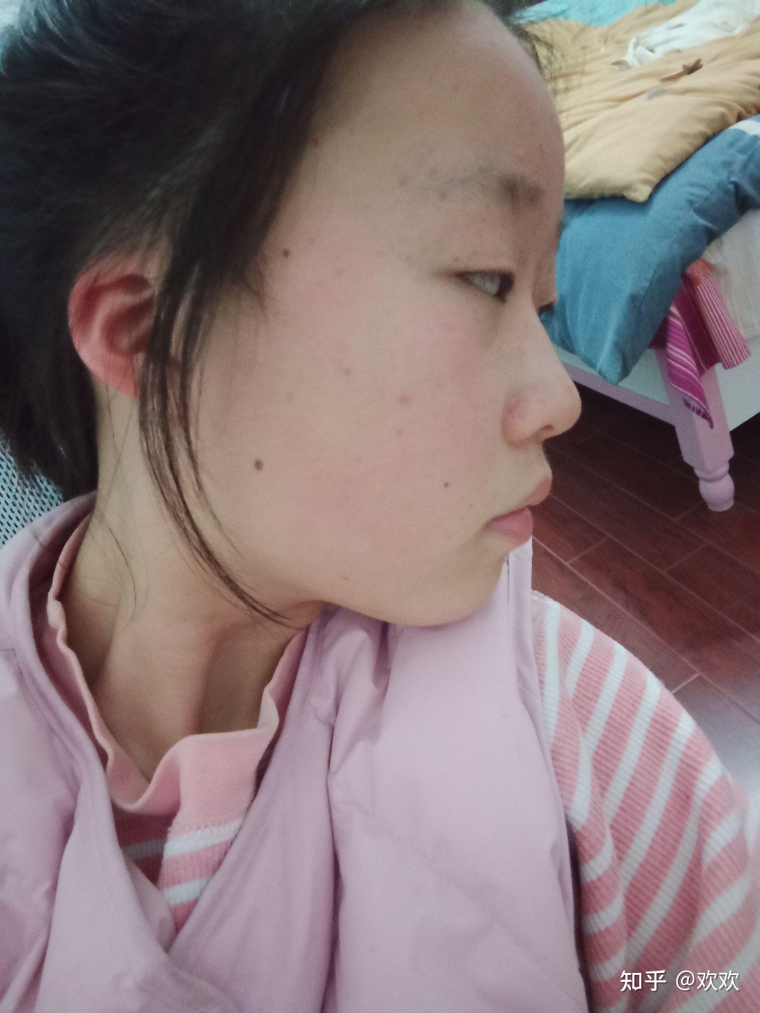 你见过鼻子塌,但是又好看的女生吗? - 知乎