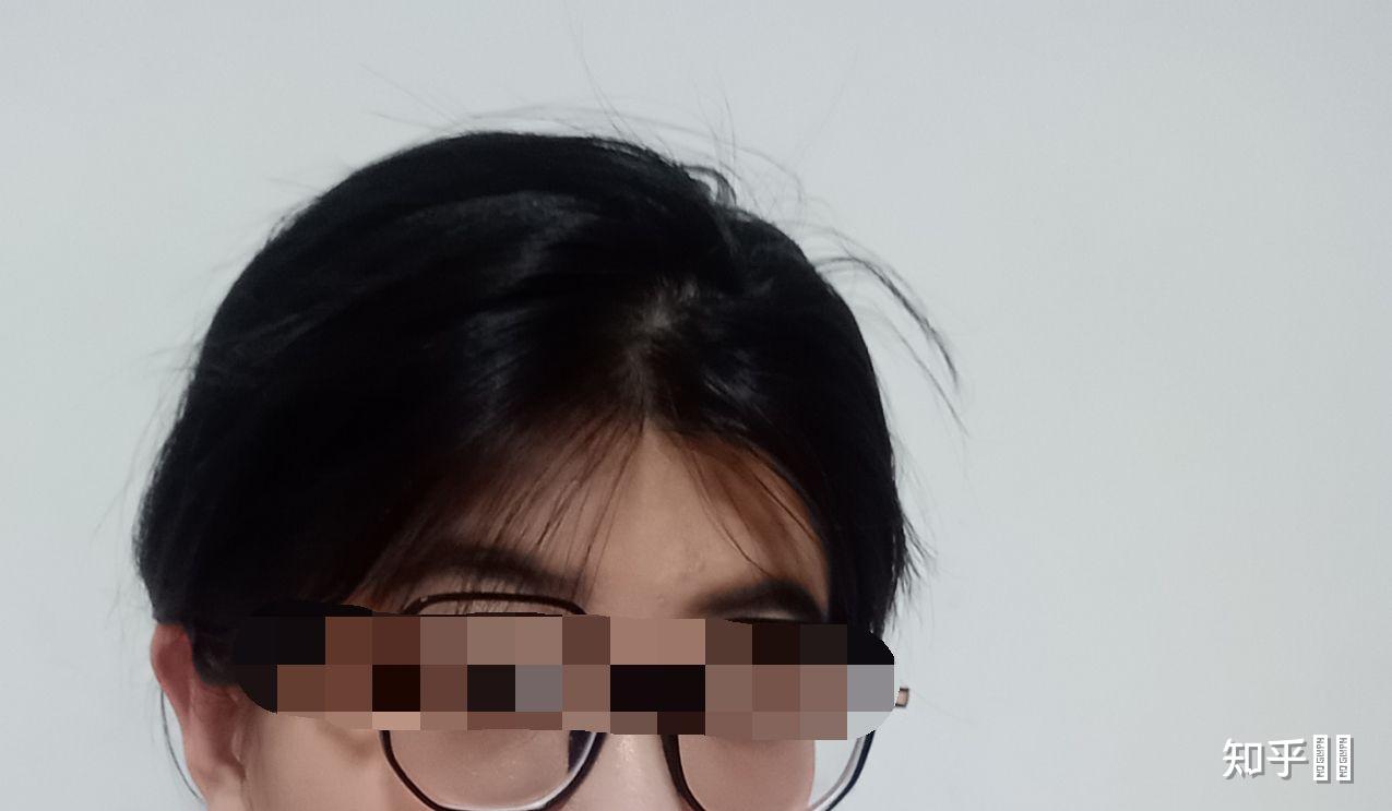 发际线太低是怎样的体验? - 知乎