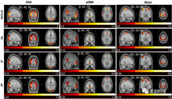 fMRI时间序列振幅和相位对功能连接分析的影响 - 知乎
